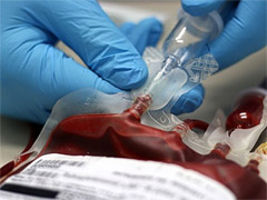 Красноярские ученые запатентовали метод защиты донорской крови
