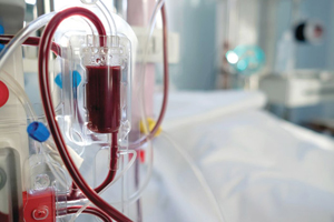 Подготовлены первые мультидисциплинарные рекомендации по искусственному кровообращению