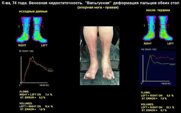 Радионуклидная диагностика